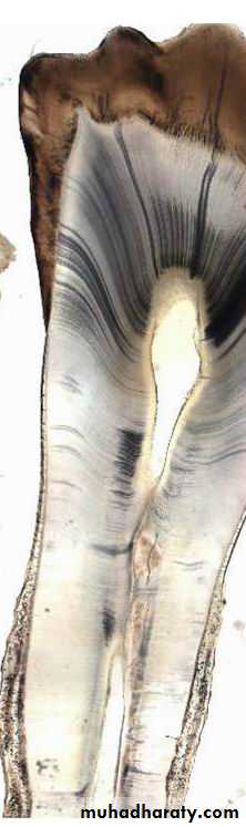 Dentin