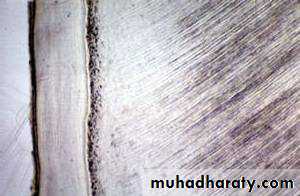 Dentin