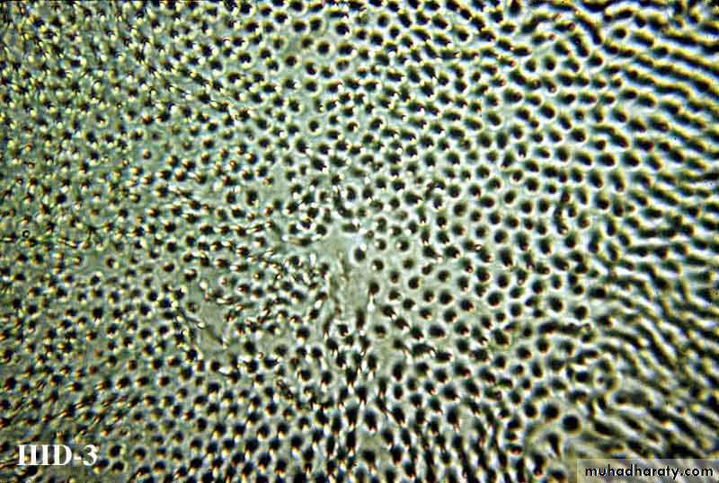 Dentin