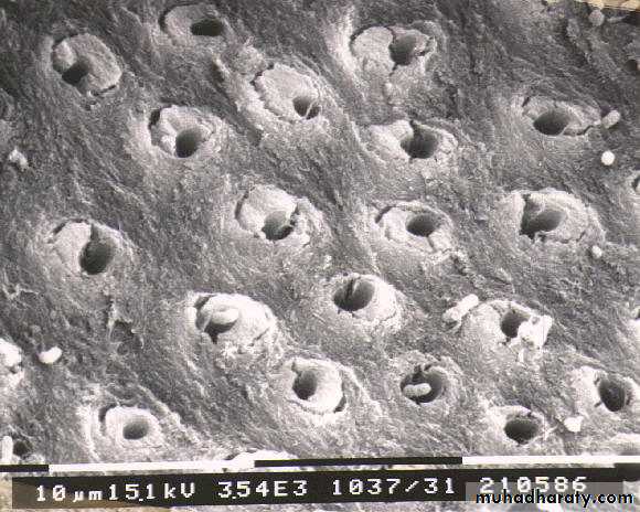 Dentin