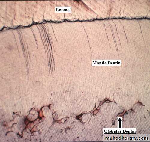 Dentin