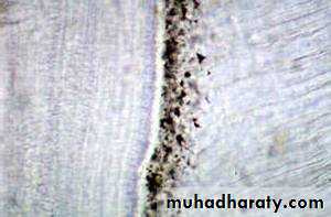 Dentin