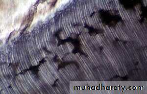 Dentin