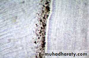Dentin