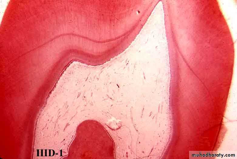Dentin