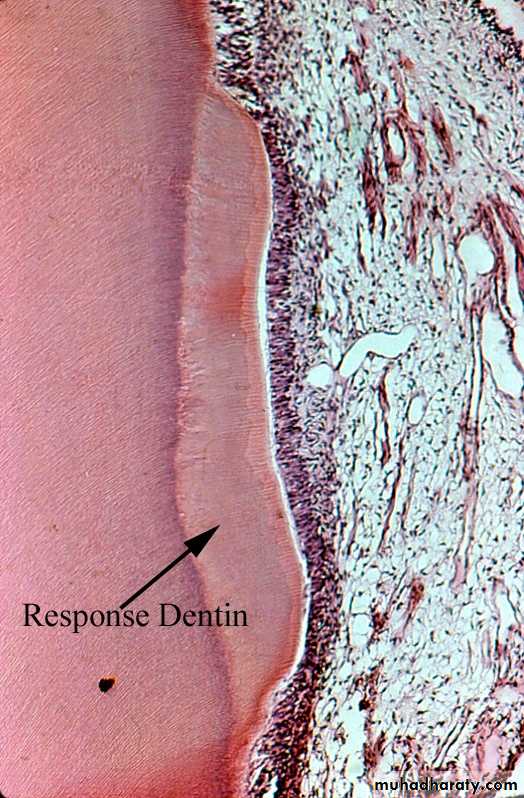 Dentin