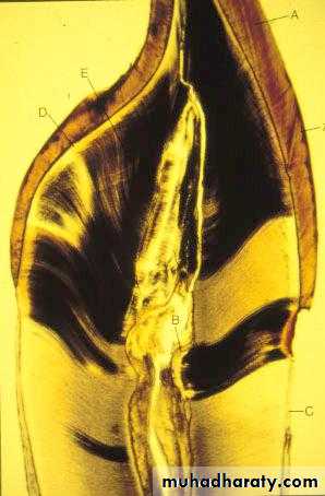 Dentin