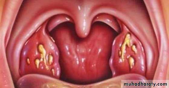 Oral microbiology