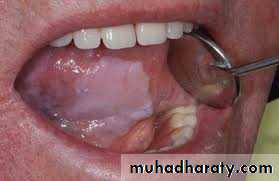 Oral microbiology