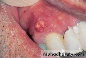 Oral microbiology