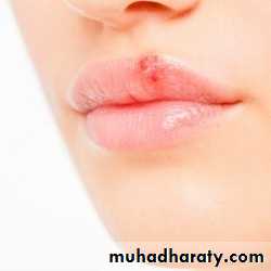 Oral microbiology