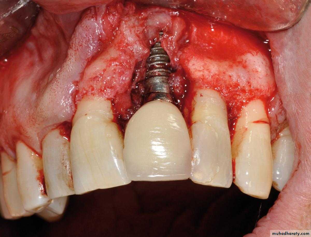 Oral microbiology
