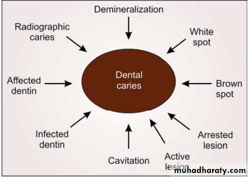 Diagnosis of caries