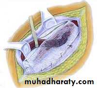 A course in medical terminology