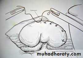 A course in medical terminology
