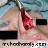 A course in medical terminology