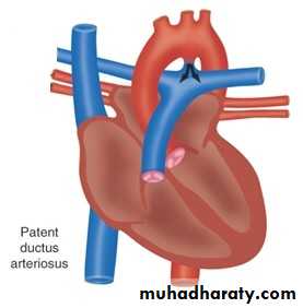 Heart disease