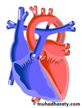 Heart disease