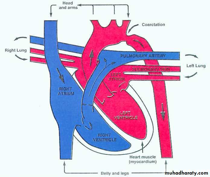 Heart disease