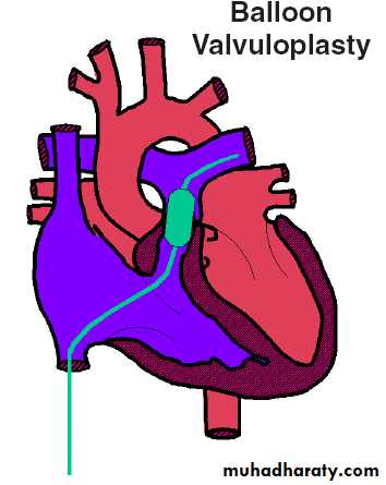 Heart disease