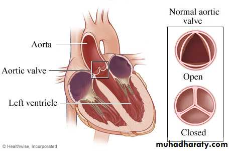 Heart disease