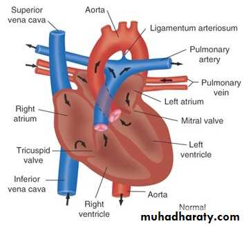 Heart disease