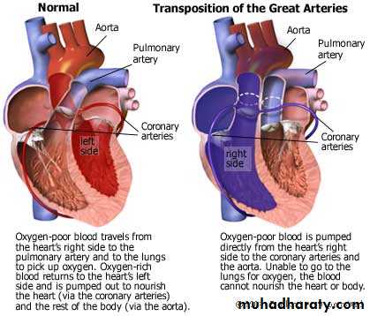 Heart disease