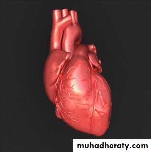 Heart disease