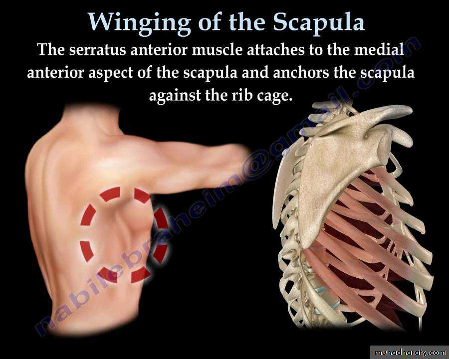 brachial pl