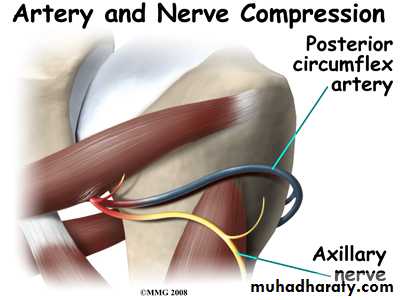 brachial pl