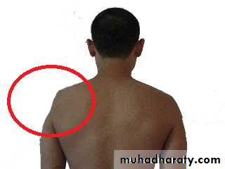 brachial pl