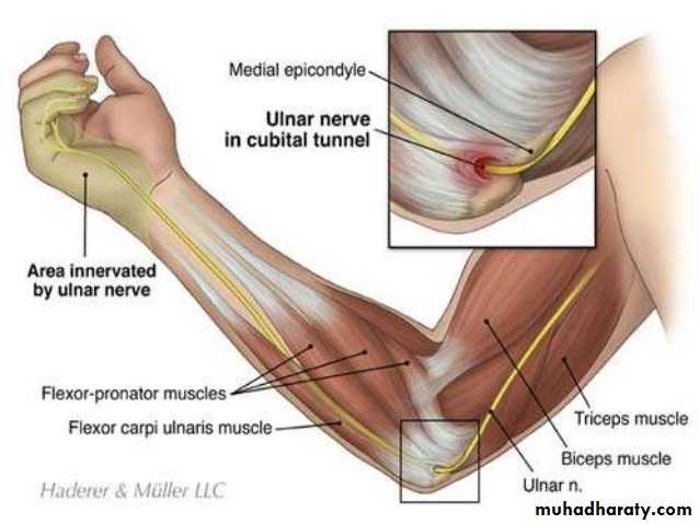 brachial pl