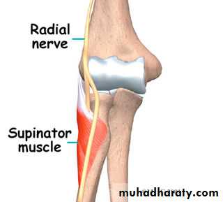 brachial pl