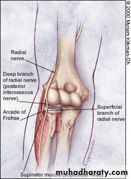 brachial pl
