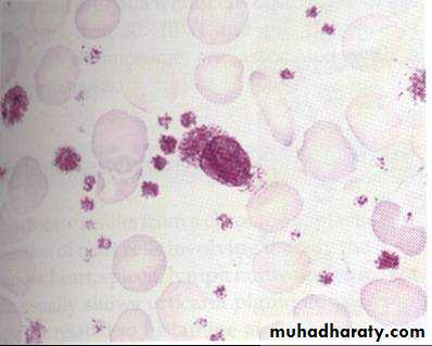 Hematology