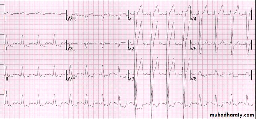 Cardiovascular system CVS