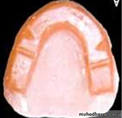 Jaw relationship II