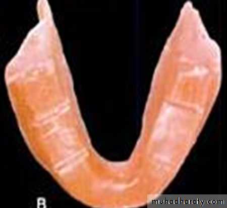 Jaw relationship II