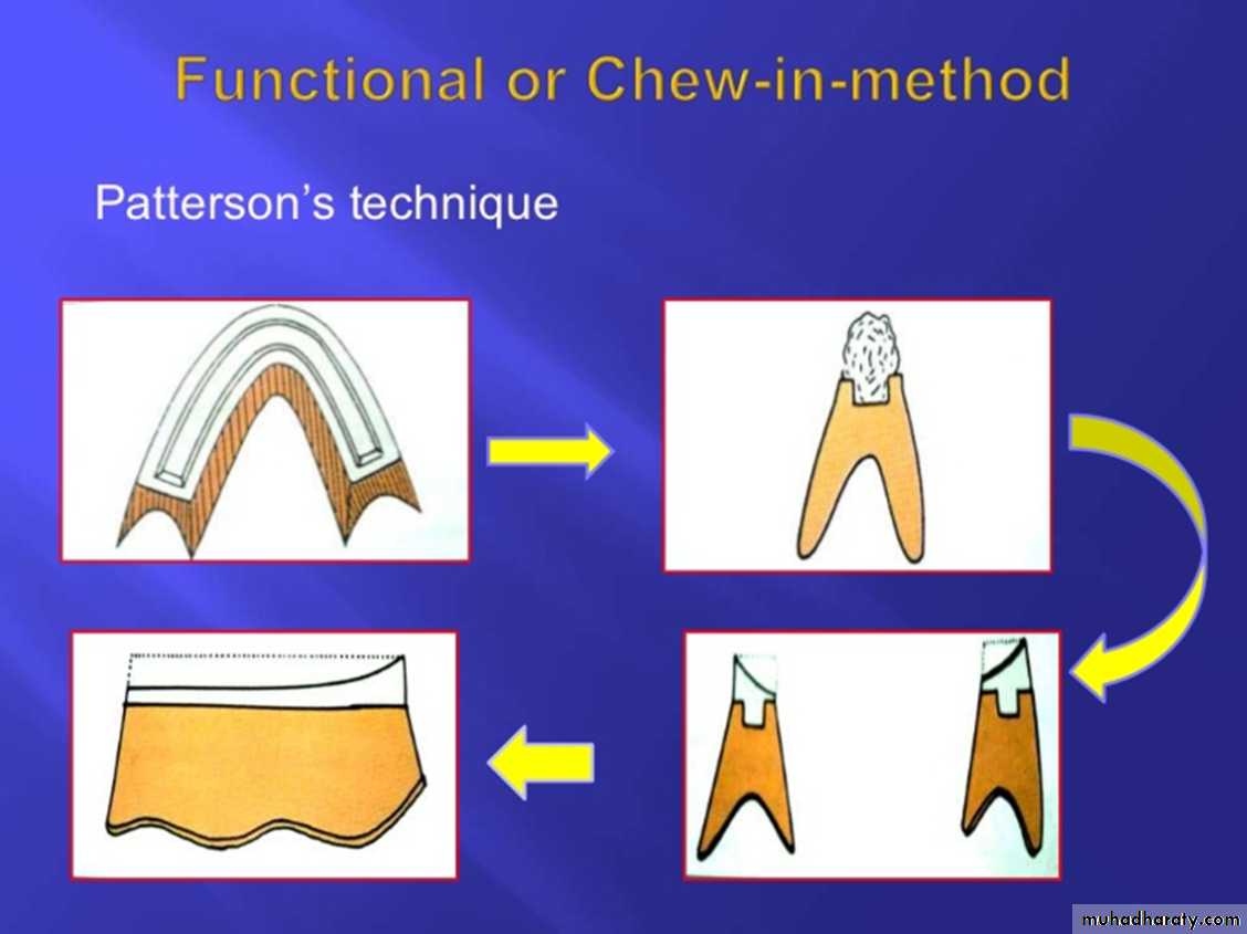 Jaw relationship II