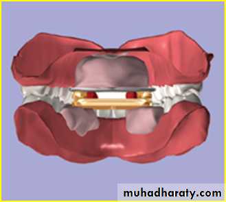 Jaw relationship II