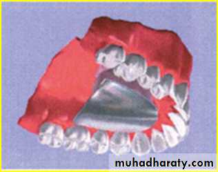 Jaw relationship II