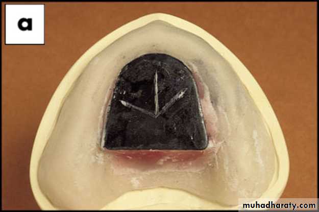 Jaw relationship II