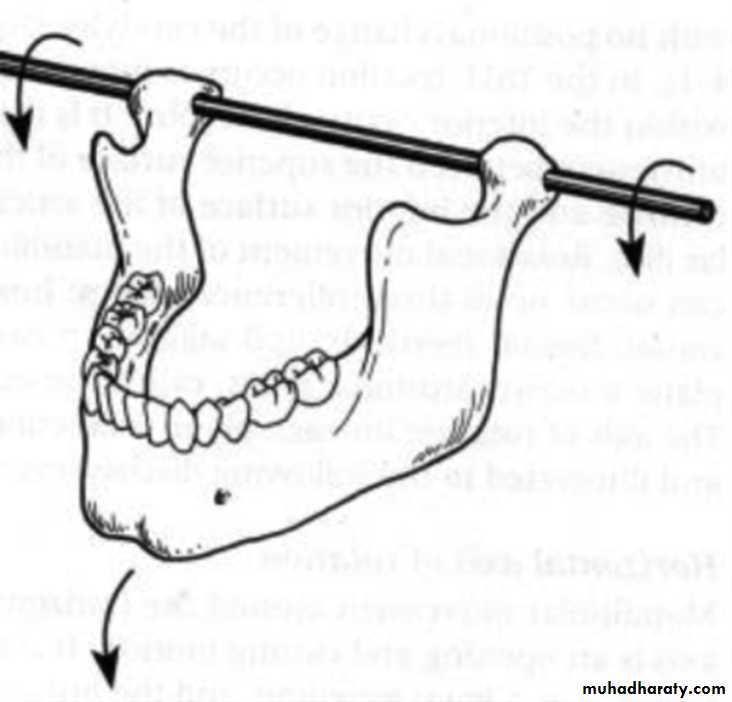Jaw relationship II