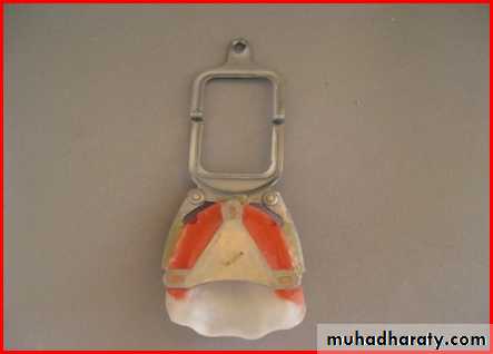 Jaw relationship II