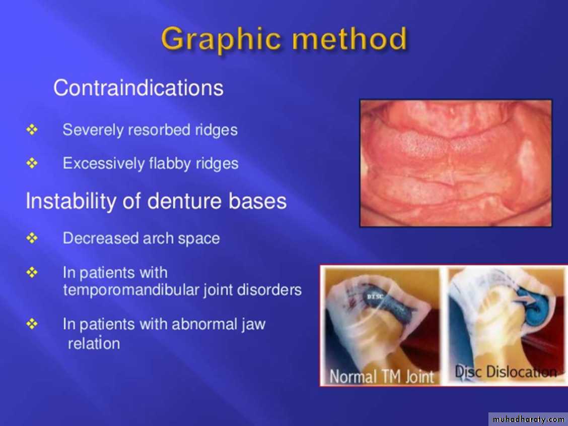 Jaw relationship II