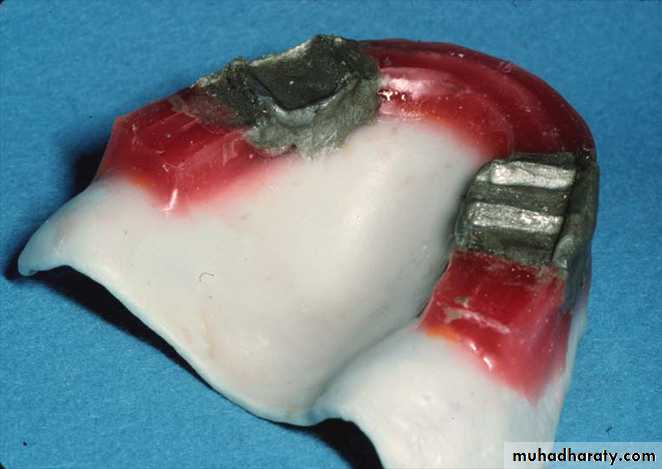 Jaw relationship II