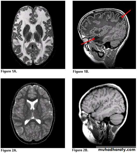 neuro