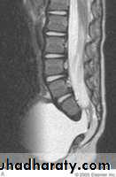 neuro