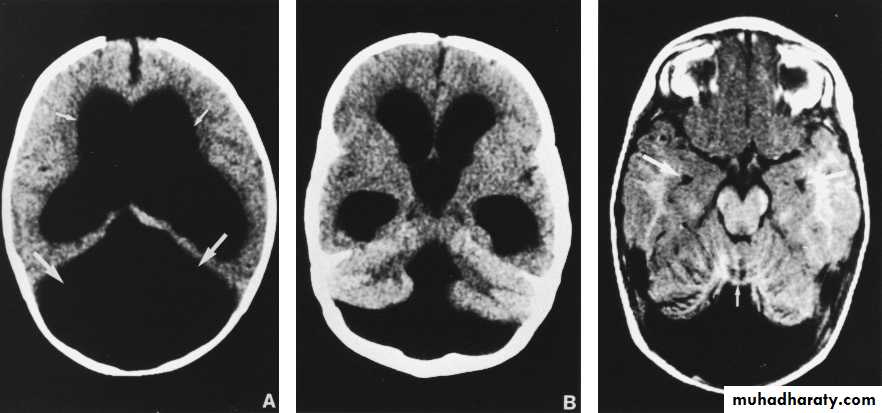 neuro