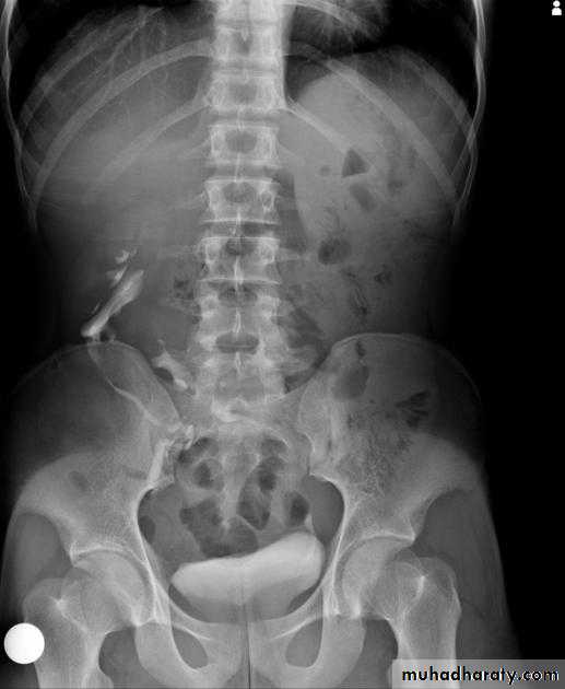 Renal system